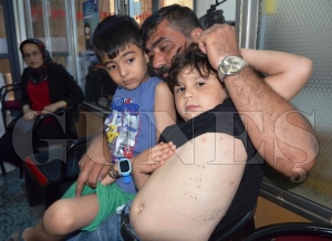 Sokak kpekleri 2 kk ocua saldrarak yaralad