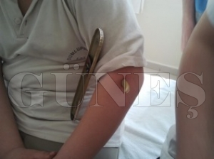Koluna Sınıf Kapısının Demir Kolu Saplandı Koluna Sınıf Kapısının Demir Kolu Saplandı