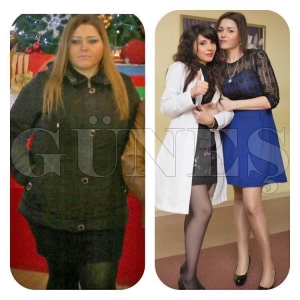 Azerbaycann  nemli Uzman Diyetisyenlerden Leman Seymanovadan zel rportaj